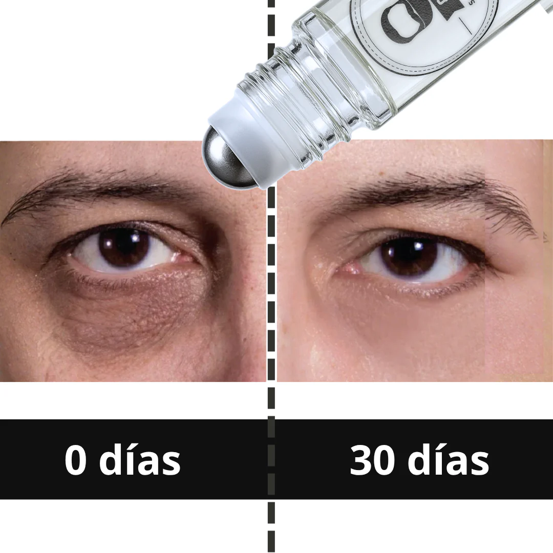 Roll On Anti Ojeras 15ml + OBSEQUIO